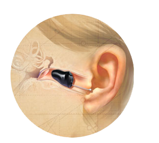 斯达克 SoundLens™玫系列隐形助听器