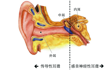 了解孩子的听力